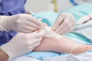 Placental Allografts.