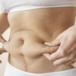 best plastic surgeon in Coimbatore